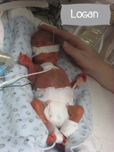 Preemie Profile: 23 Week Twins Olivia & Logan