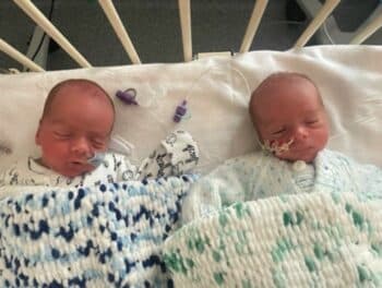 Jacob and Jaxon James at University Hospitals of North Midlands