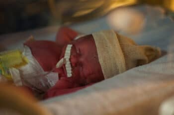 premature baby NICU