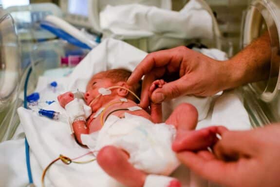 Premature baby lies in the incubator