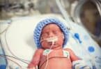 Newborn premature baby in the NICU intensive care