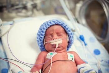 Newborn premature baby in the NICU intensive care