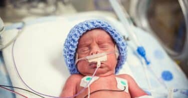 Newborn premature baby in the NICU intensive care