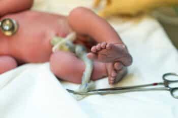 New born baby, feet and umbilical cord