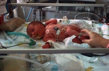 Newborn preemie in neonatal intensive care unit