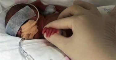 Baby Born at 22 Weeks Defies Odds in Shanghai