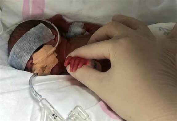 Baby Born at 22 Weeks Defies Odds in Shanghai