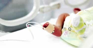 Newborn Baby Leg Wrapped With Device In Hospital