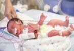Newborn premature baby in the NICU intensive care